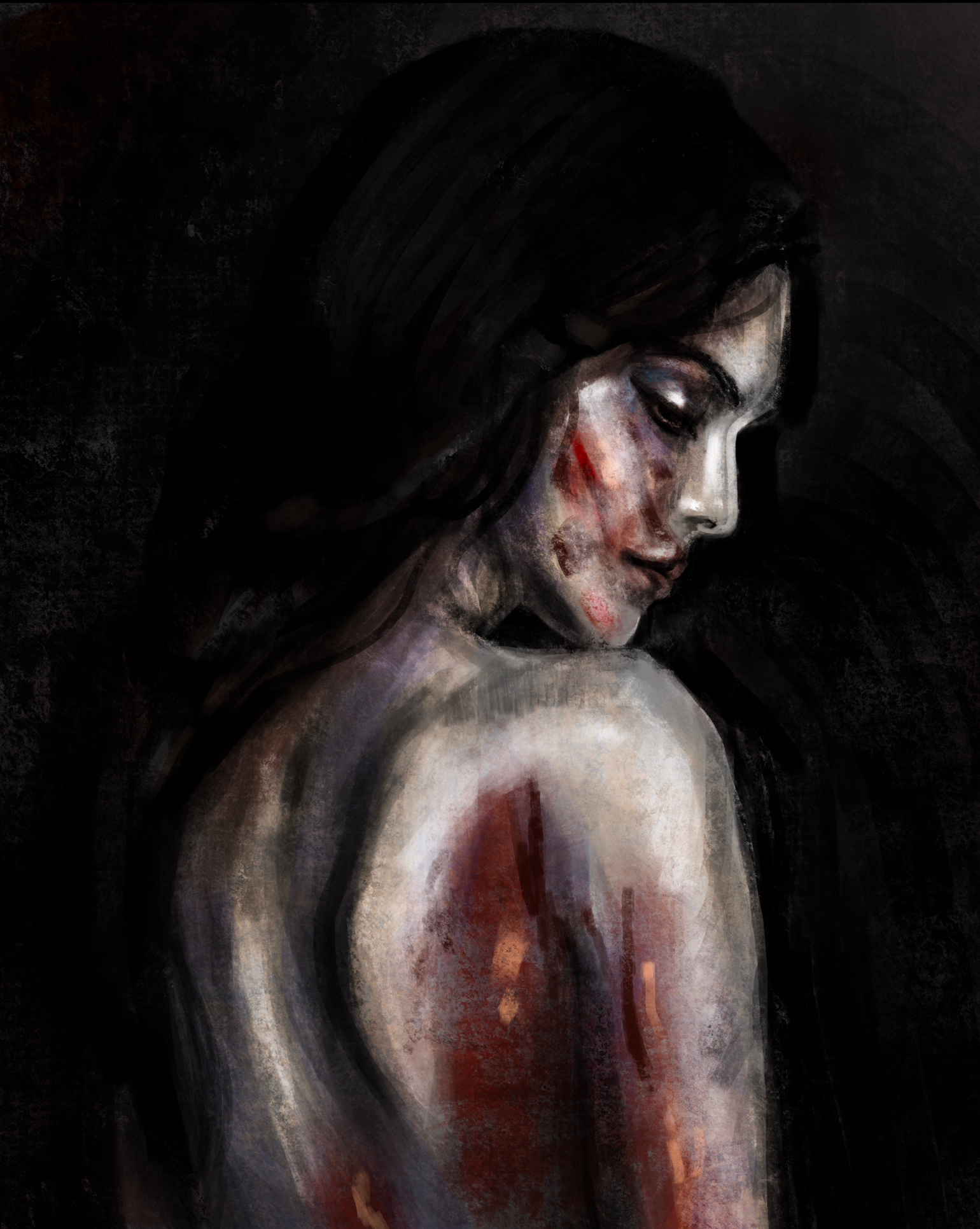 Wounded